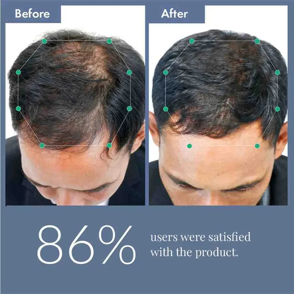 ThriveCo Hair Power Serum