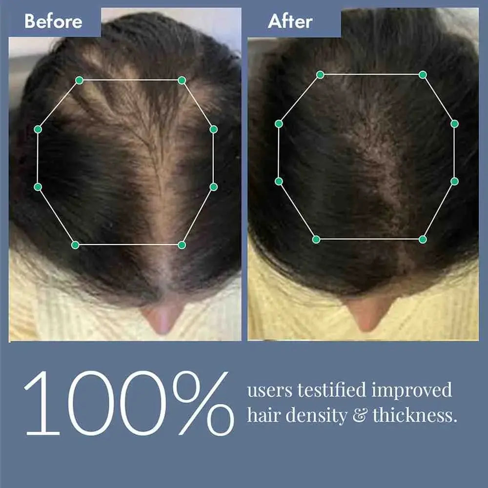 ThriveCo Hair Power Serum